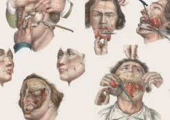Crucial Interventions: An Illustrated Treatise on the Principles & Practice of Nineteenth-Century Surgery.
