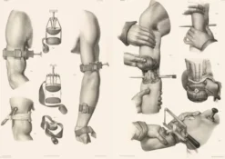 Crucial Interventions: An Illustrated Treatise on the Principles & Practice of Nineteenth-Century Surgery.